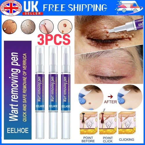 Pack hours wart remover - 12,