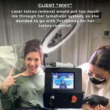 Picosecond Laser Tattoo Removal Machine Pigment Pico Skin Rejuvenation Nd YAG US