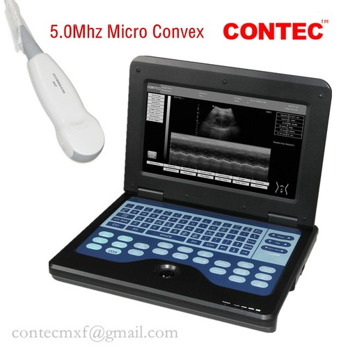 Cms600p2 portable ultrasound - cms600p2,