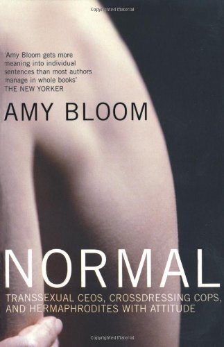 Normal transs ual ceos - transs**ual,