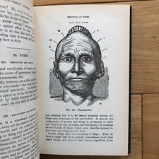 1856 Memory and Intellectual