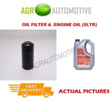 FOR MG ZT-T 2.5 177 BHP