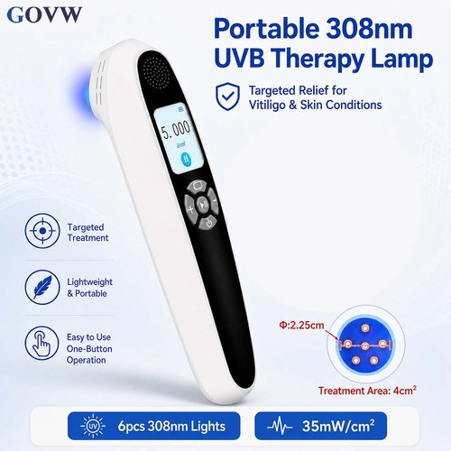 308nm uvb phototherapy device - 308nm,