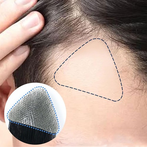 Temple hair patches human - temple,