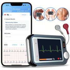CheckmeEX ECG Monitor Heart