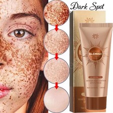 Face Whitening Mask Blemish