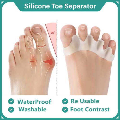 2pcs silicone toe separator - 2pcs,