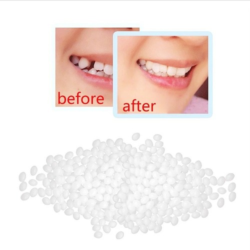 50g tooth repair - 10/30/50g,
