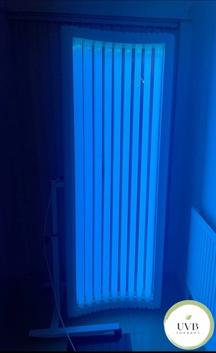 Uvb light therapy - therapy, unit