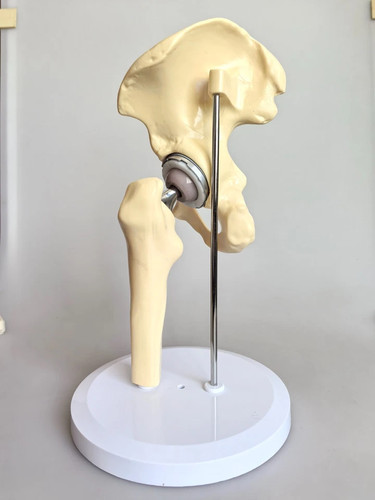 Artificial size hip joint - hip,
