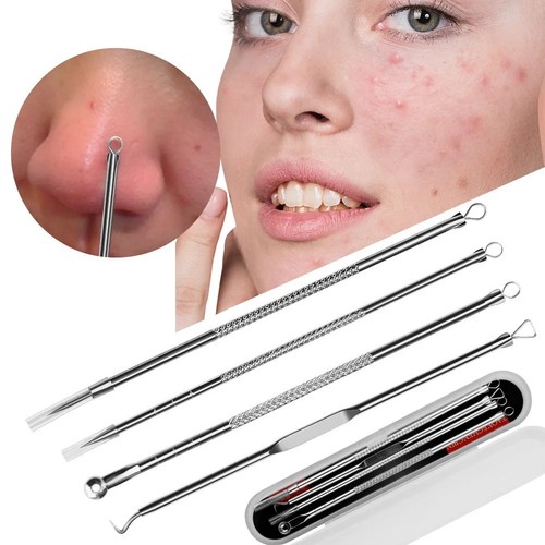 Blackhead remover tool kit - 4x,