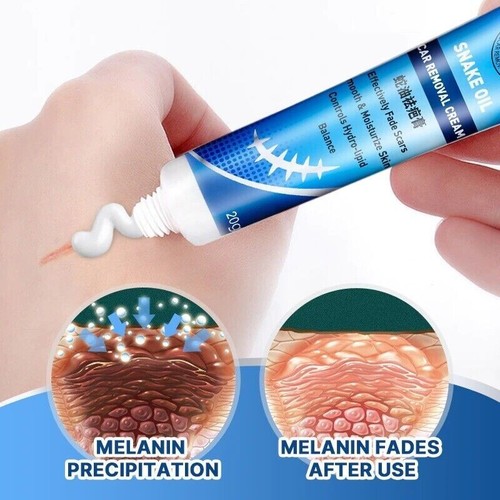 Skin repair healing scar - healing, cream
