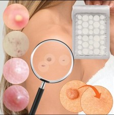 72pcs Skin Tag Remover Patches