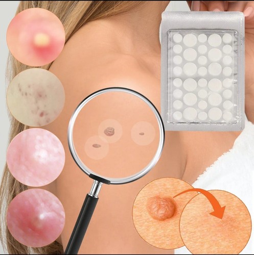 72pcs skin tag remover - 72pcs, patches