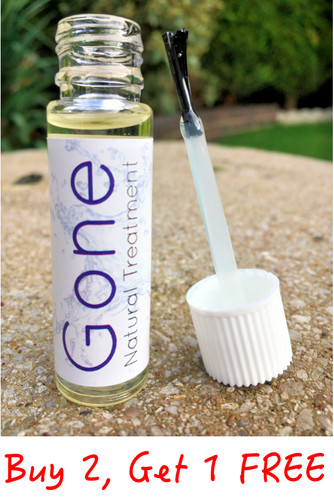 Callus corn remover liquid - &,