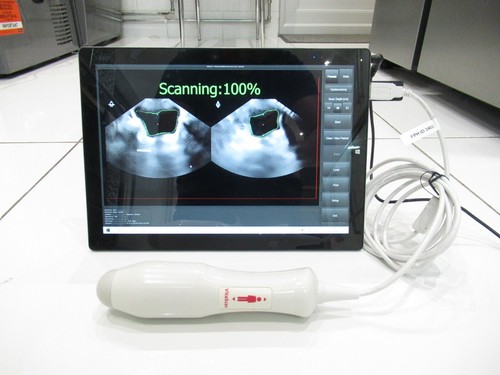Vitacon vitascan portable - vitacon,