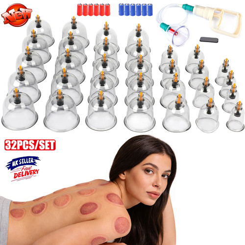 32x cupping vacuum massage - cupping,
