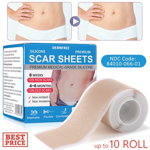 Medical grade scar removal - grade,