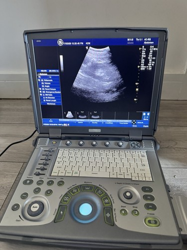 Logiq ultrasound scanner - logiq,
