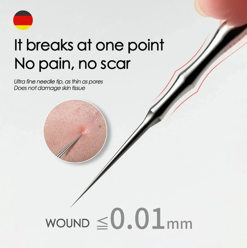 1pcs german blackhead removal - 1pcs,