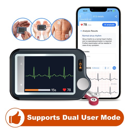 Checkme personal mobile ekg - mobile,