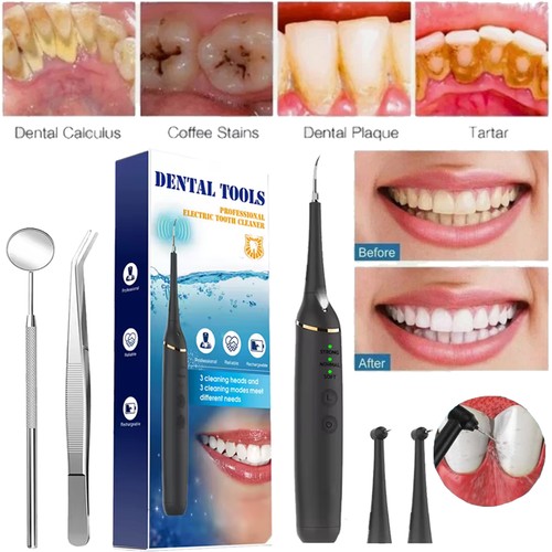 Electric ultrasonic dental - ultrasonic,