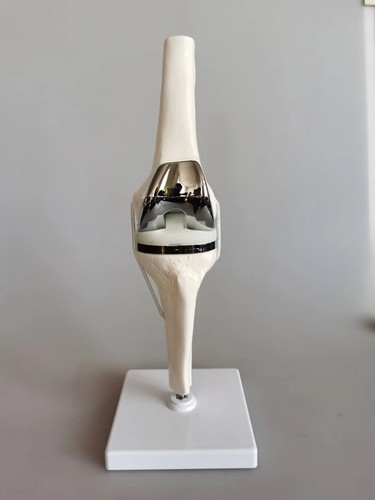 Artificial knee joint - 1:1,