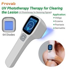 308nm Narrowband UVB Light