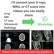 If You Are Using Anagel 250ml