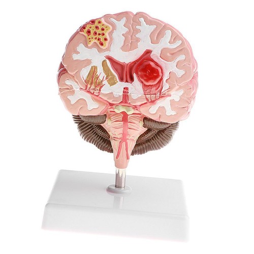 Anatomical human brain model - brain,