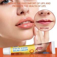 New 20g Lip Herpes Cream Dry