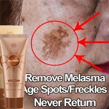 Face Whitening Mask Blemish