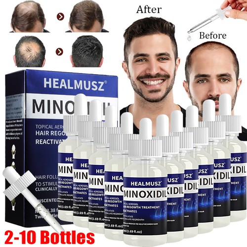 Minoxidil topical solution - topical,