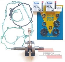 Kawasaki KX100 2002 Bottom End