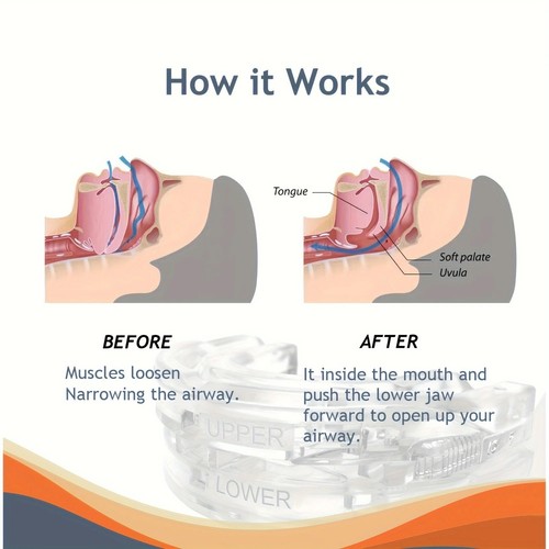 Genuine anti snoring mouth - anti,