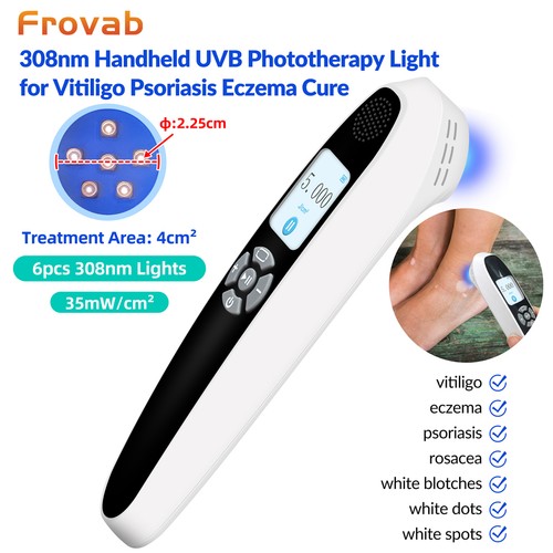 308nm uvb phototherapy device - 308nm,