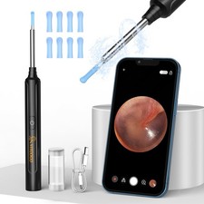 Ear Wax Removal Kit Ear Camera