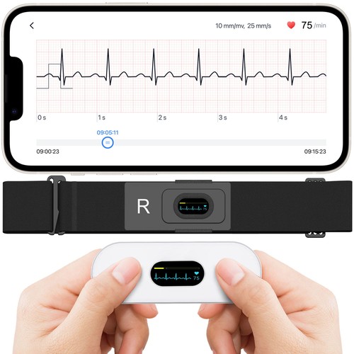 Checkme er2 mobile ecg - checkme,