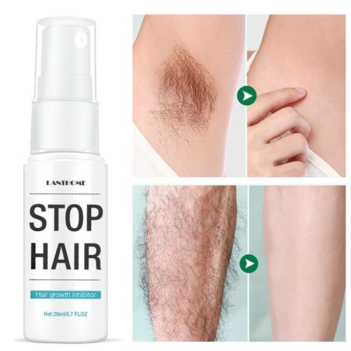 Permanent hair growth - permanent,