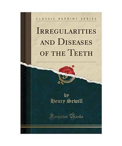 Irregularities and diseases - irregularities,