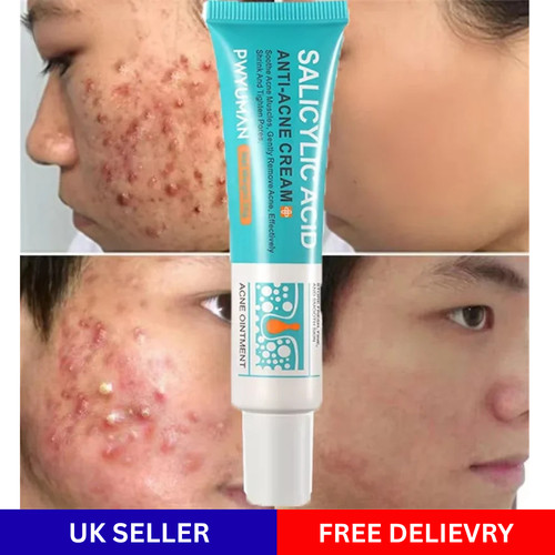 Salicylic acid strong acne - acid,