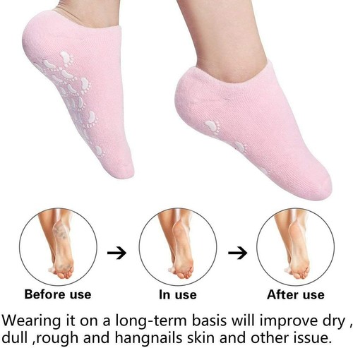 Moisturising gel socks dry - dm,