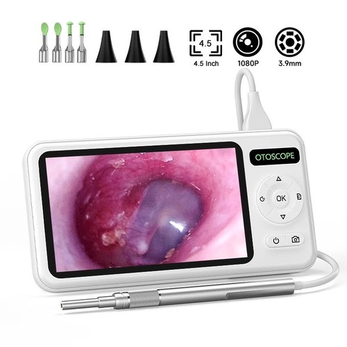 Inch digital otoscope - inch,