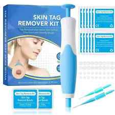 Natural Painless Auto SKIN TAG