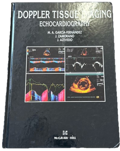 Doppler tissue imaging - doppler,