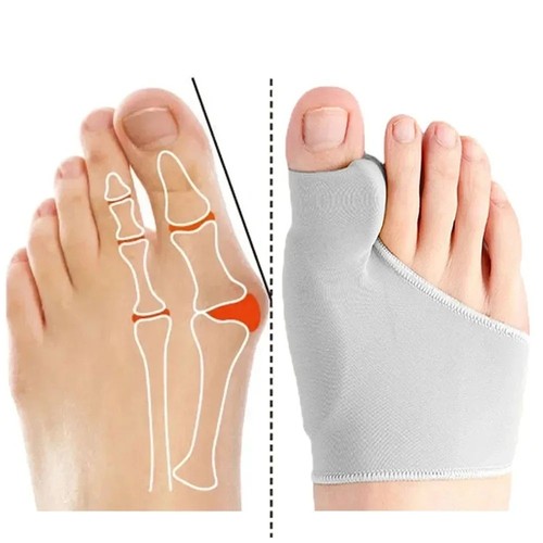 Big toe bunion corrector - bunion,