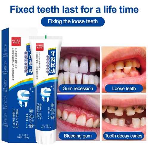 2026 new loose teeth - teeth, care