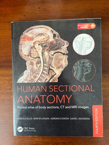 Human sectional anatomy - human,