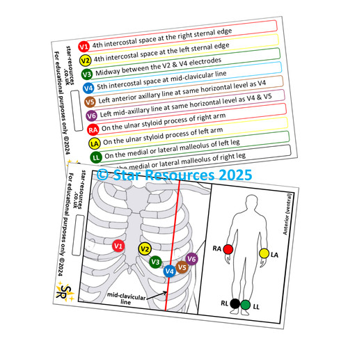 Ecg lead placement badge - ecg,