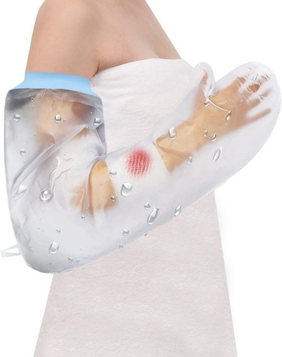 Cast protection for - protection,
